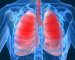 7 cách giúp phổi luôn khỏe mạnh