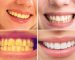 “Bí mật” giúp răng trắng bóng không cần tới nha sỹ